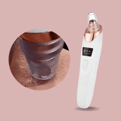 Easy Pore Blackhead Remover Tool for Clear Skin - Befez