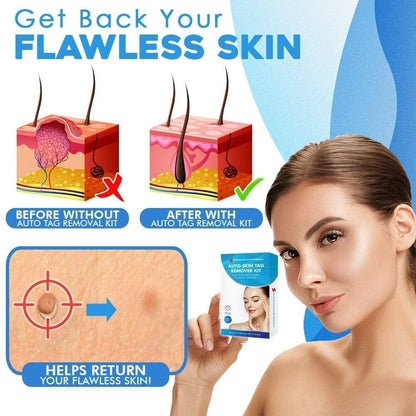 Easy Hair Removal Device for Smooth Skin