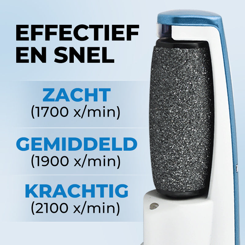 SoftFeet Exfoliator for Smooth Feet