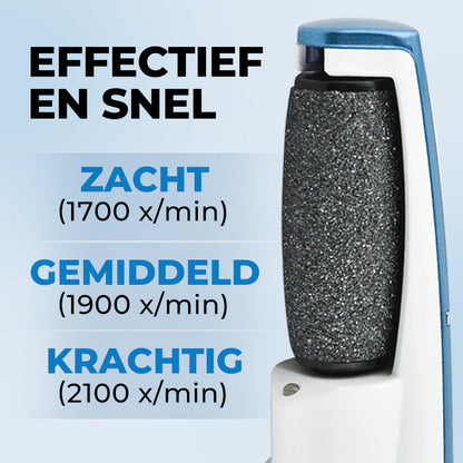 SoftFeet Exfoliator for Smooth Feet