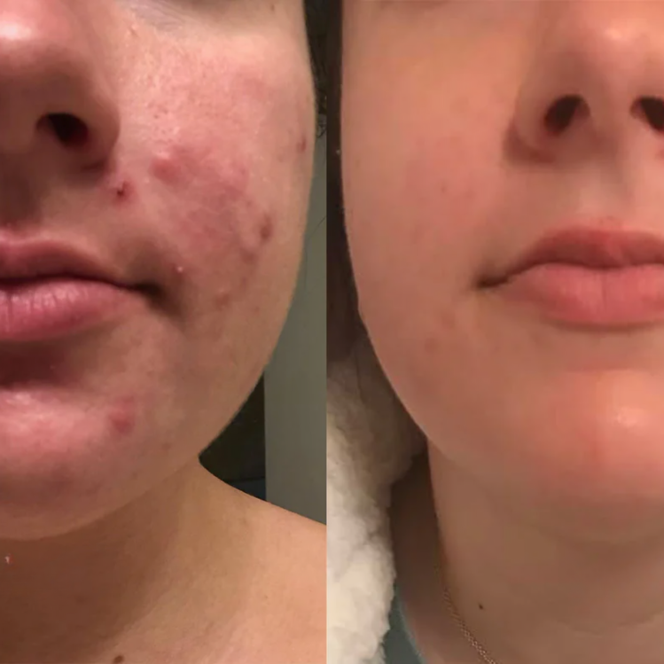 Clear Skin Serum for Glowing Complexion