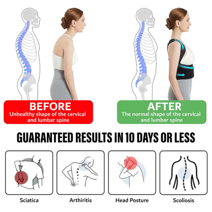 Posture Corrector Back Support Brace