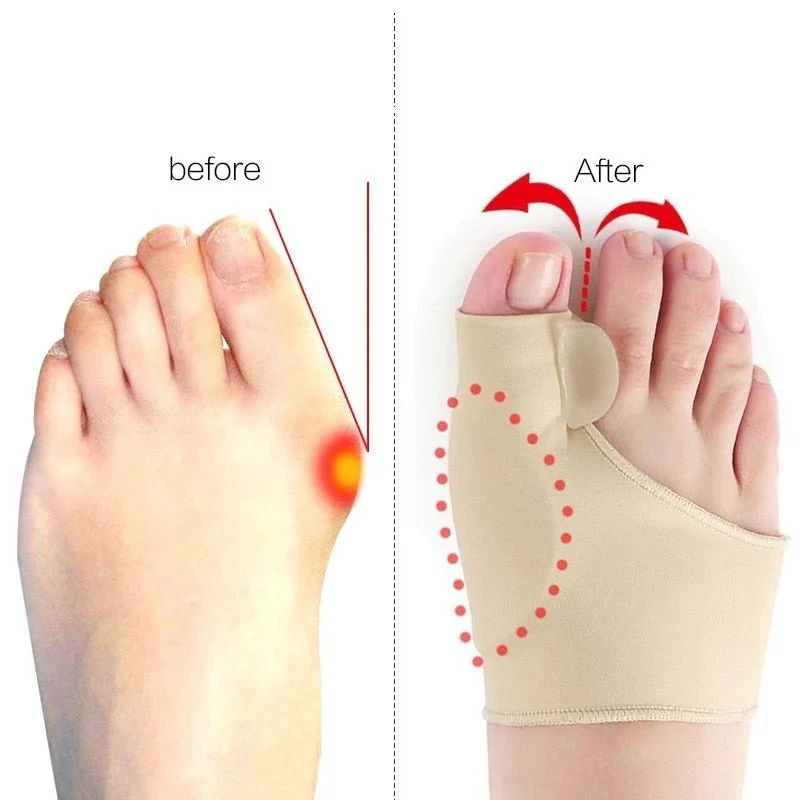 Gel Toe Spacer with Comfort Alignment