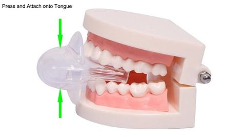Anti Snore Tongue Stabilizer Device