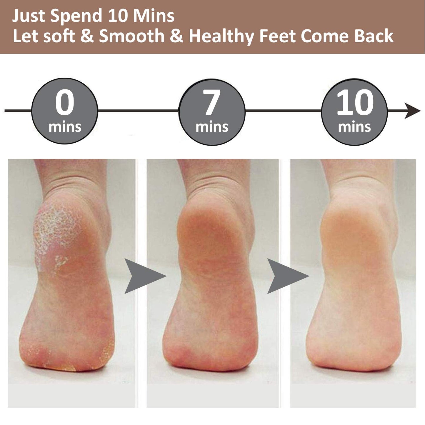 Professional Electric Foot Callus Remover