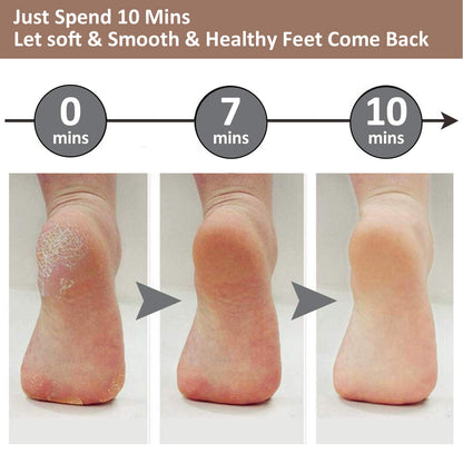 Professional Electric Foot Callus Remover