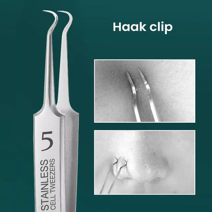 Easy Spot Pimple Removal Tool