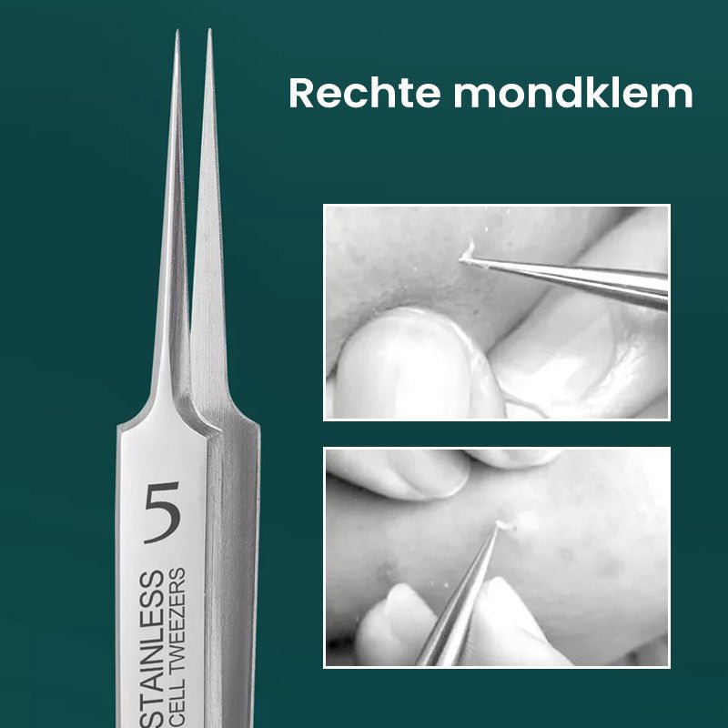 Easy Spot Pimple Removal Tool - Befez