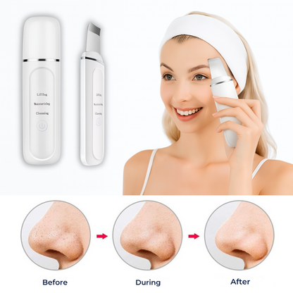 Advanced Facial Cleansing Wand - Deep Pore Cleaner