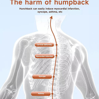 Smart Posture Corrector with Vibration Alert