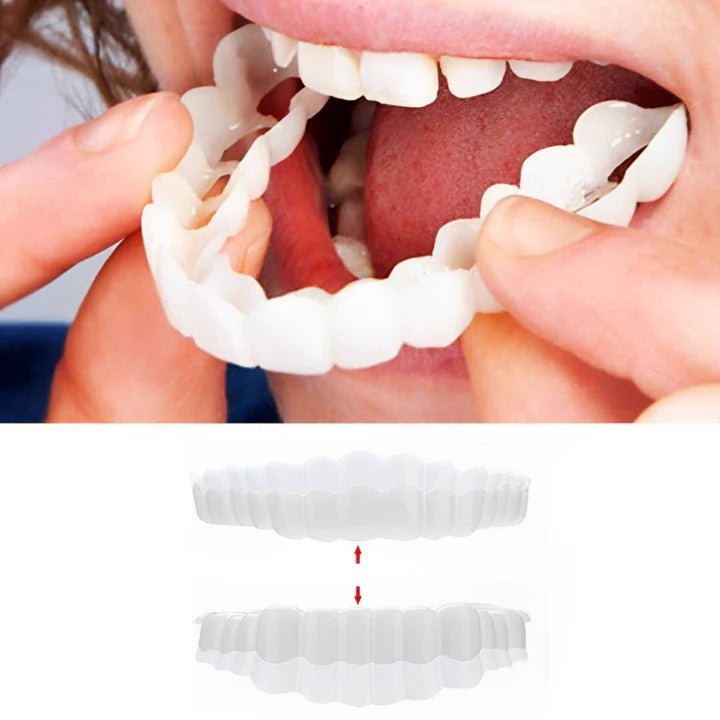 Reusable Snap On Smile Veneers for Top and Bottom Teeth - Befez