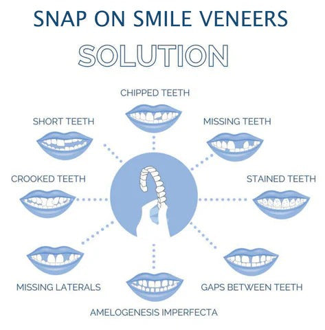 Reusable Snap On Smile Veneers for Top and Bottom Teeth