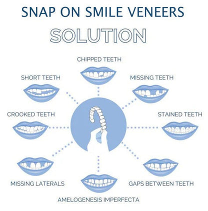 Reusable Snap On Smile Veneers for Top and Bottom Teeth