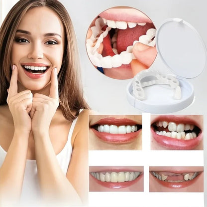 Realistic Smile Dental Veneers with Bright Finish
