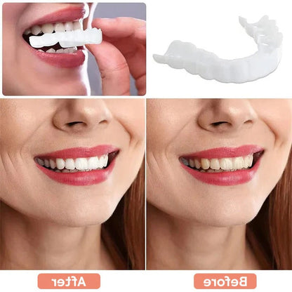 Realistic Smile Dental Veneers with Bright Finish