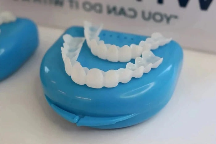 Realistic Smile Dental Veneers with Bright Finish