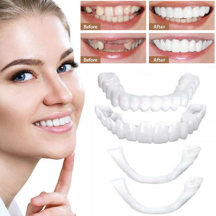 Realistic Smile Dental Veneers with Bright Finish