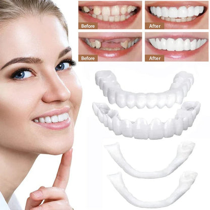Realistic Smile Dental Veneers with Bright Finish
