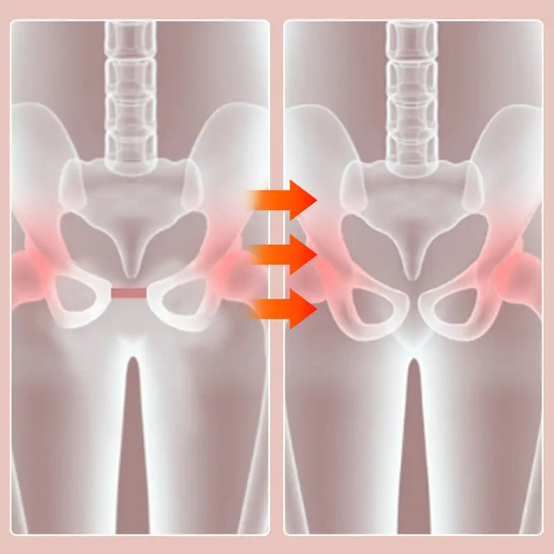 Electronic Pelvic Floor Exerciser