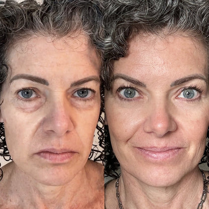 Befez EyeRevive Revitalizing Eye Cream
