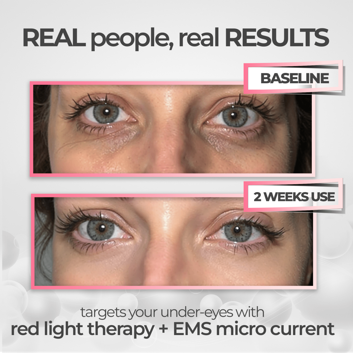 Befez EyeRevive Revitalizing Eye Cream