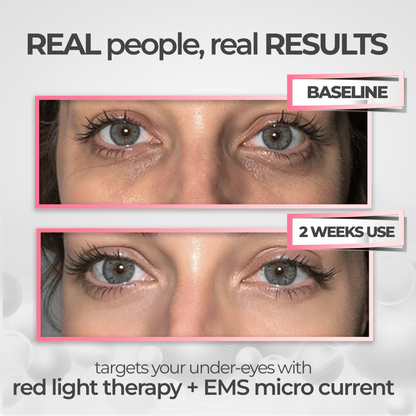 Befez EyeRevive Revitalizing Eye Cream