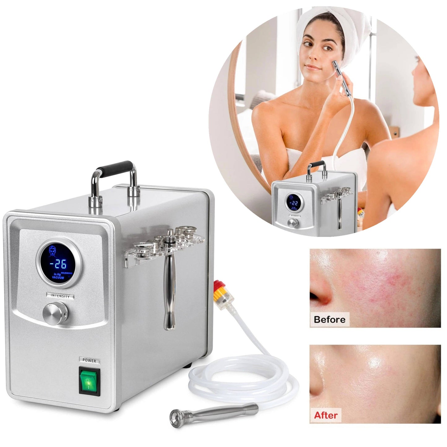 Advanced Home Microdermabrasion Skin Care Machine - Befez