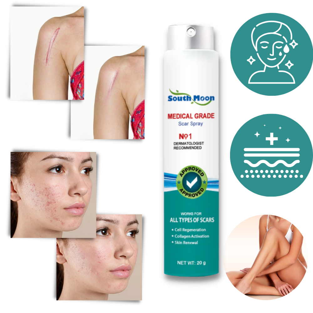 Effective Scar Reducing Spray Treatment