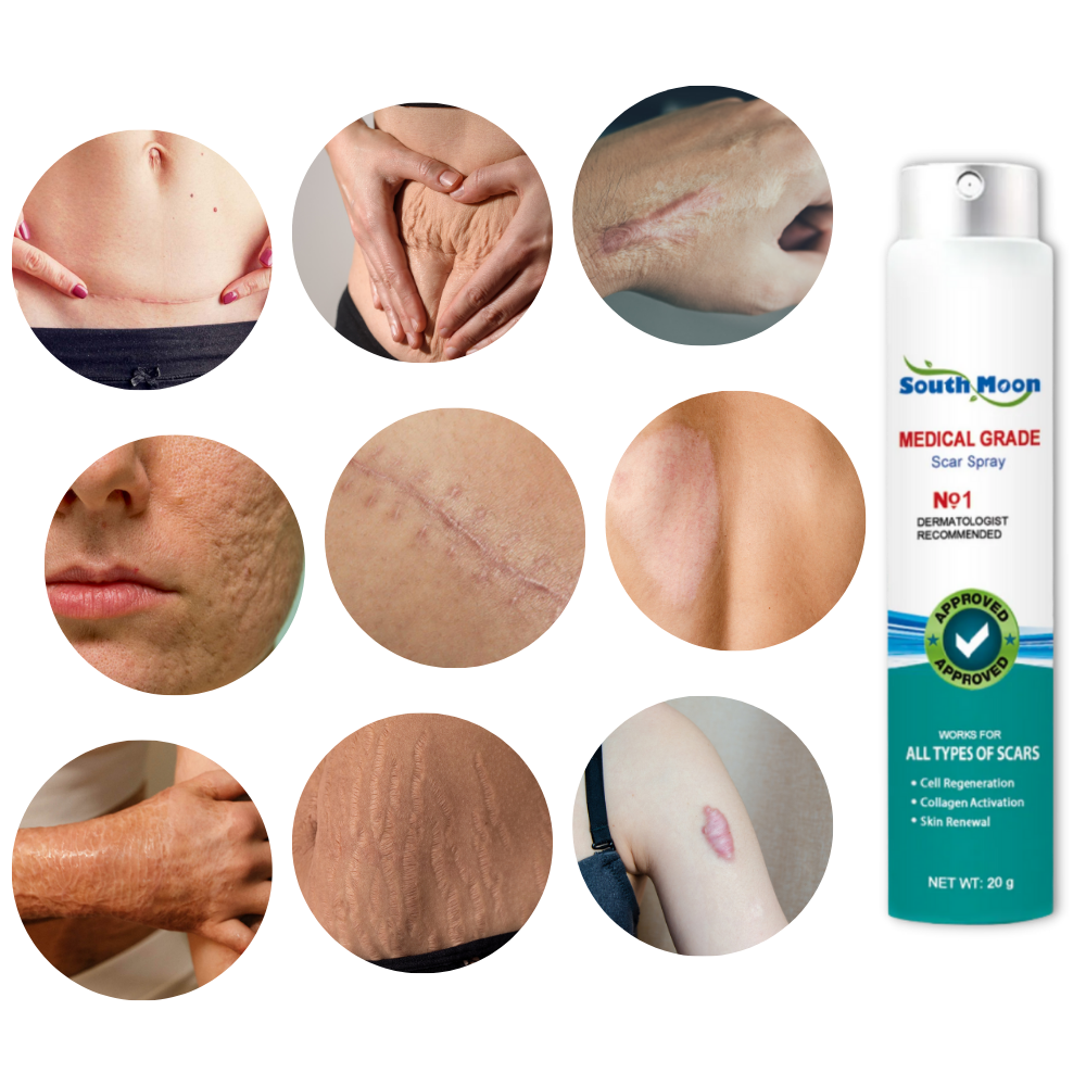 Effective Scar Reducing Spray Treatment