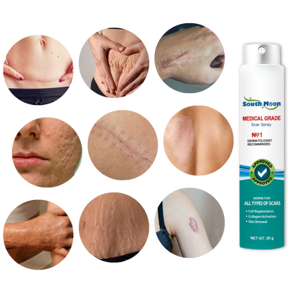 Effective Scar Reducing Spray Treatment