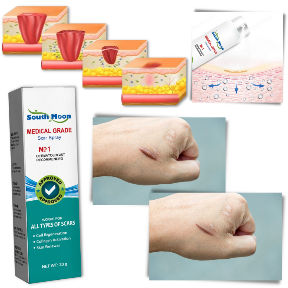 Effective Scar Reducing Spray Treatment