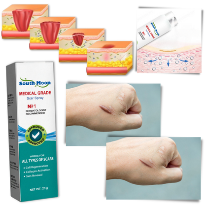 Effective Scar Reducing Spray Treatment