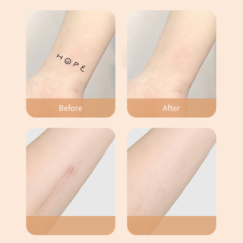 Thin Skin Concealer Patch for Tattoos and Scars