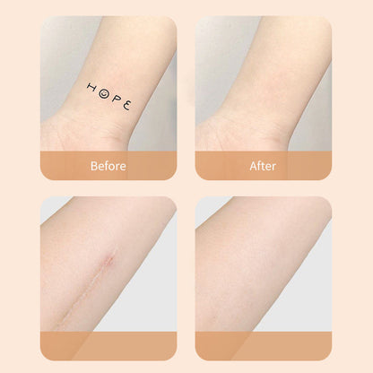 Thin Skin Concealer Patch for Tattoos and Scars