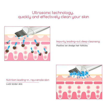 Advanced Facial Cleansing Ultrasonic Skin Tool